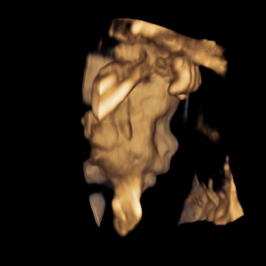 Photo shared by Ashlyn for their Babylist baby registry.