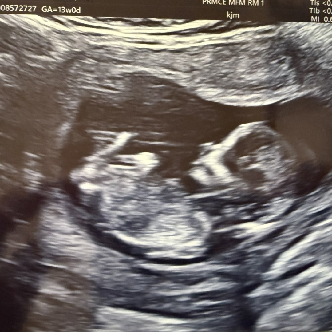 Photo shared by Danielle for their Babylist baby registry.