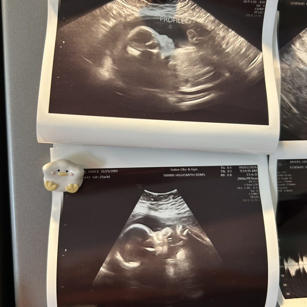 Photo shared by Grace for their Babylist baby registry.