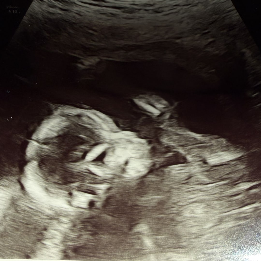 Photo shared by Madison for their Babylist baby registry.