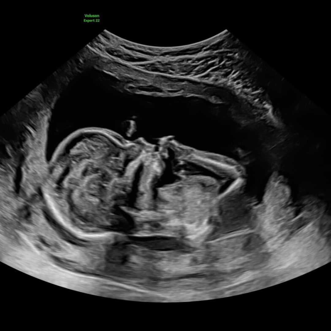 Photo shared by Sarah for their Babylist baby registry.