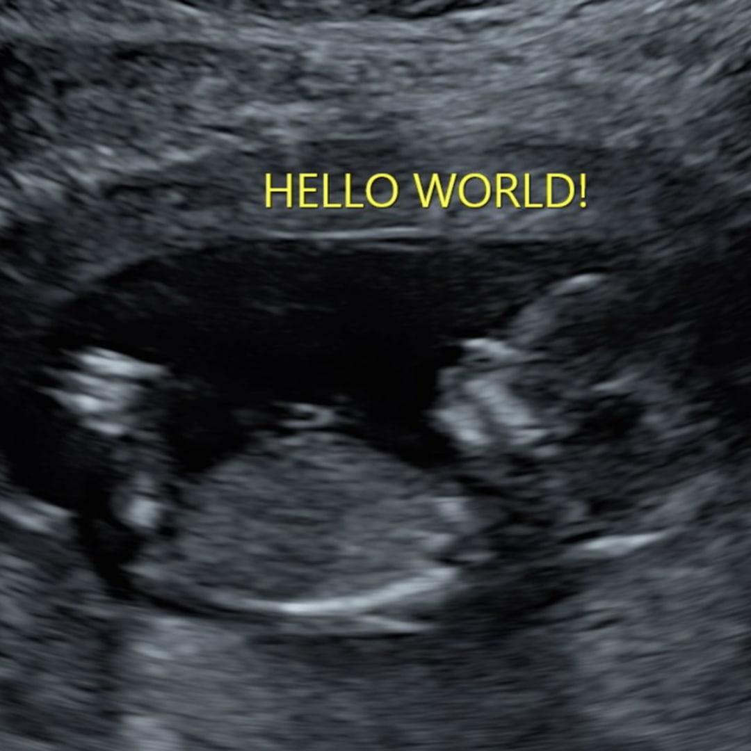 Photo shared by Gabbie for their Babylist baby registry.