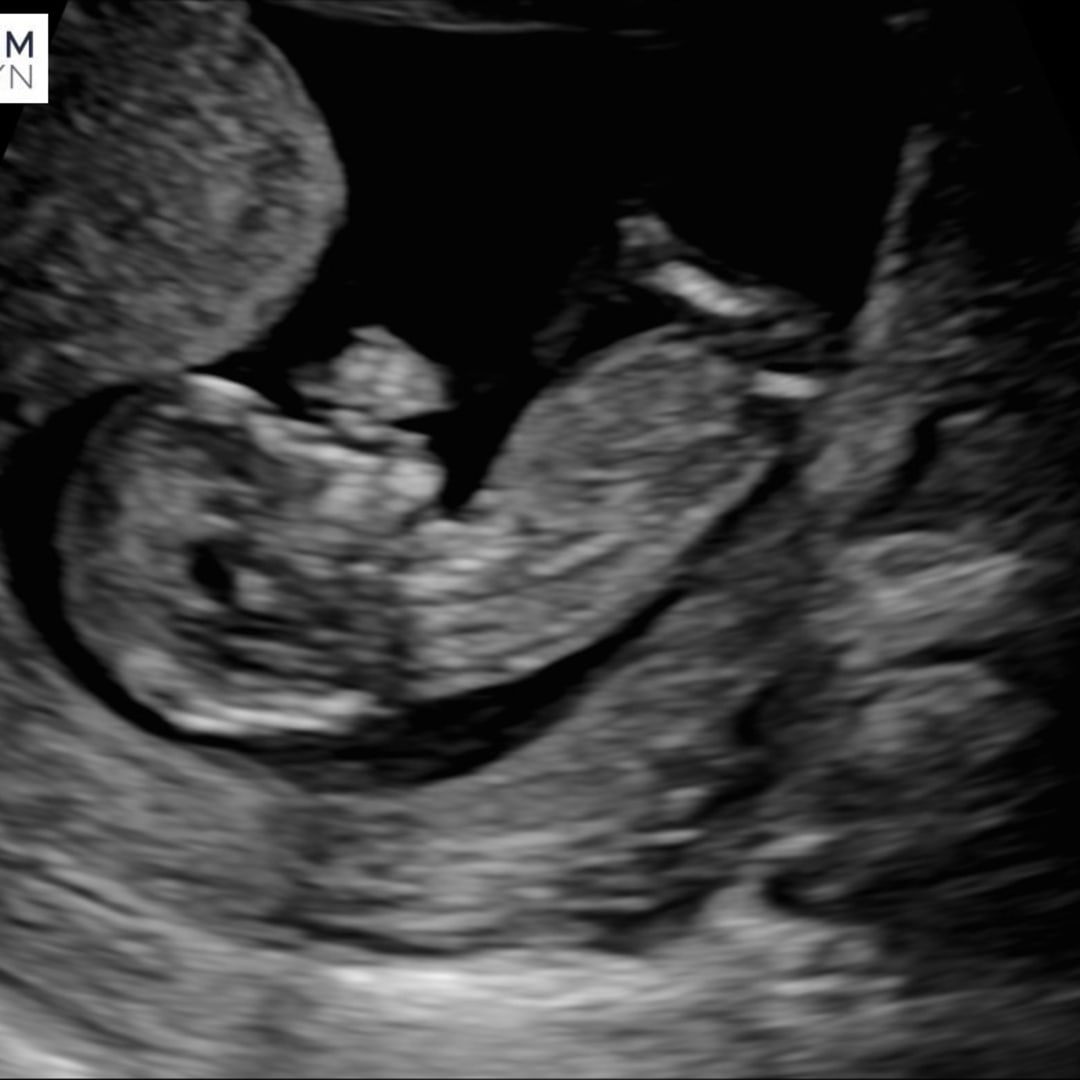 Photo shared by Liza for their Babylist baby registry.