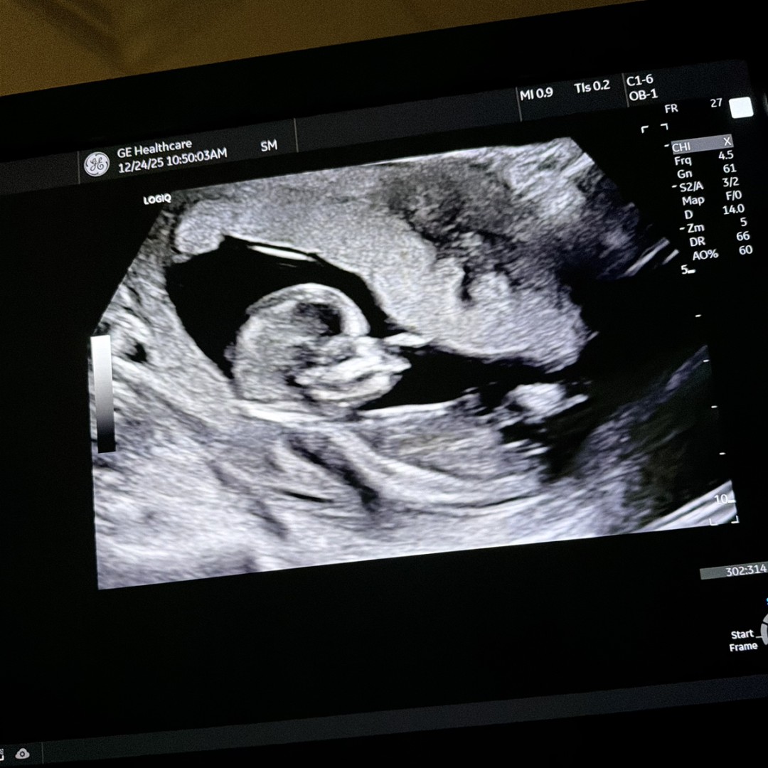 Photo shared by Janelle for their Babylist baby registry.