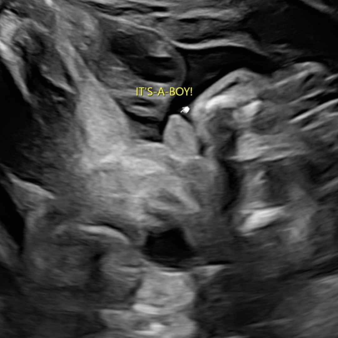 Photo shared by Alexa for their Babylist baby registry.