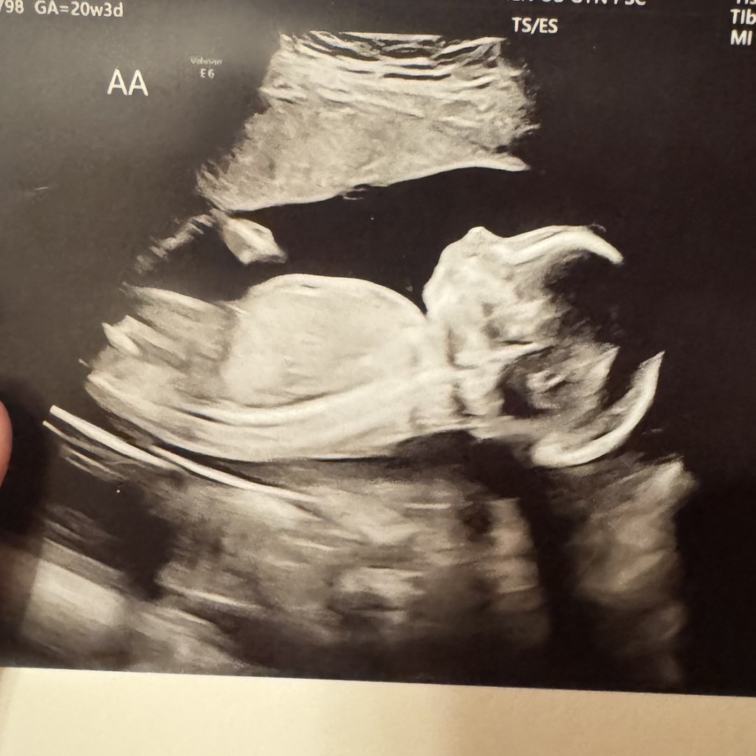 Photo shared by Abbie for their Babylist baby registry.