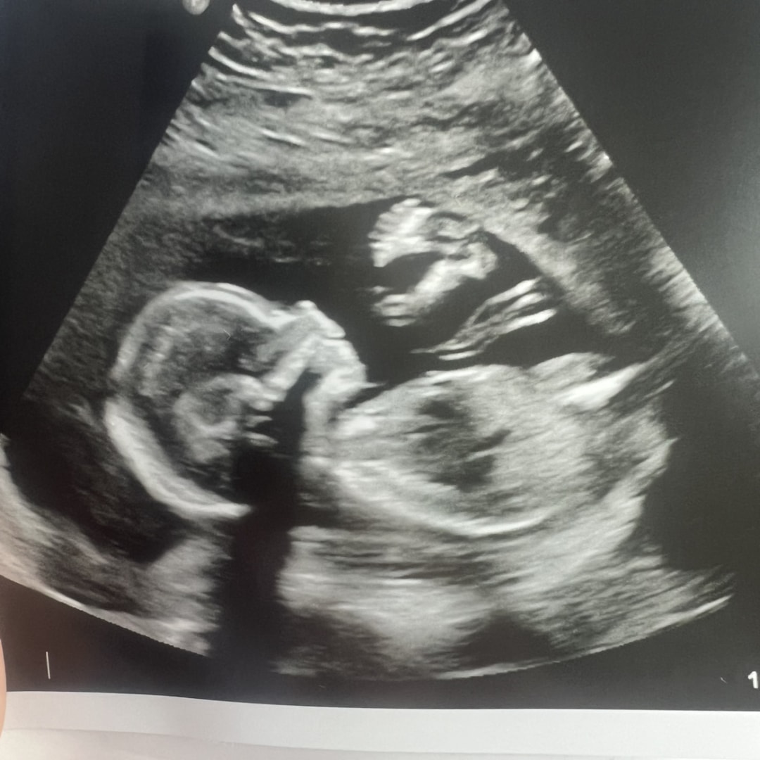 Photo shared by Carly for their Babylist baby registry.