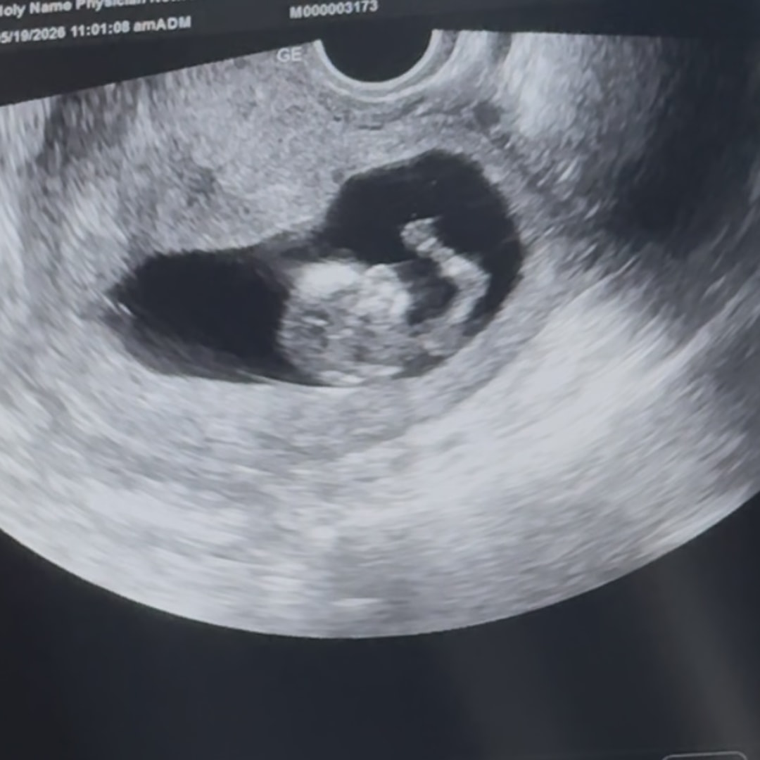Photo shared by Melody for their Babylist baby registry.