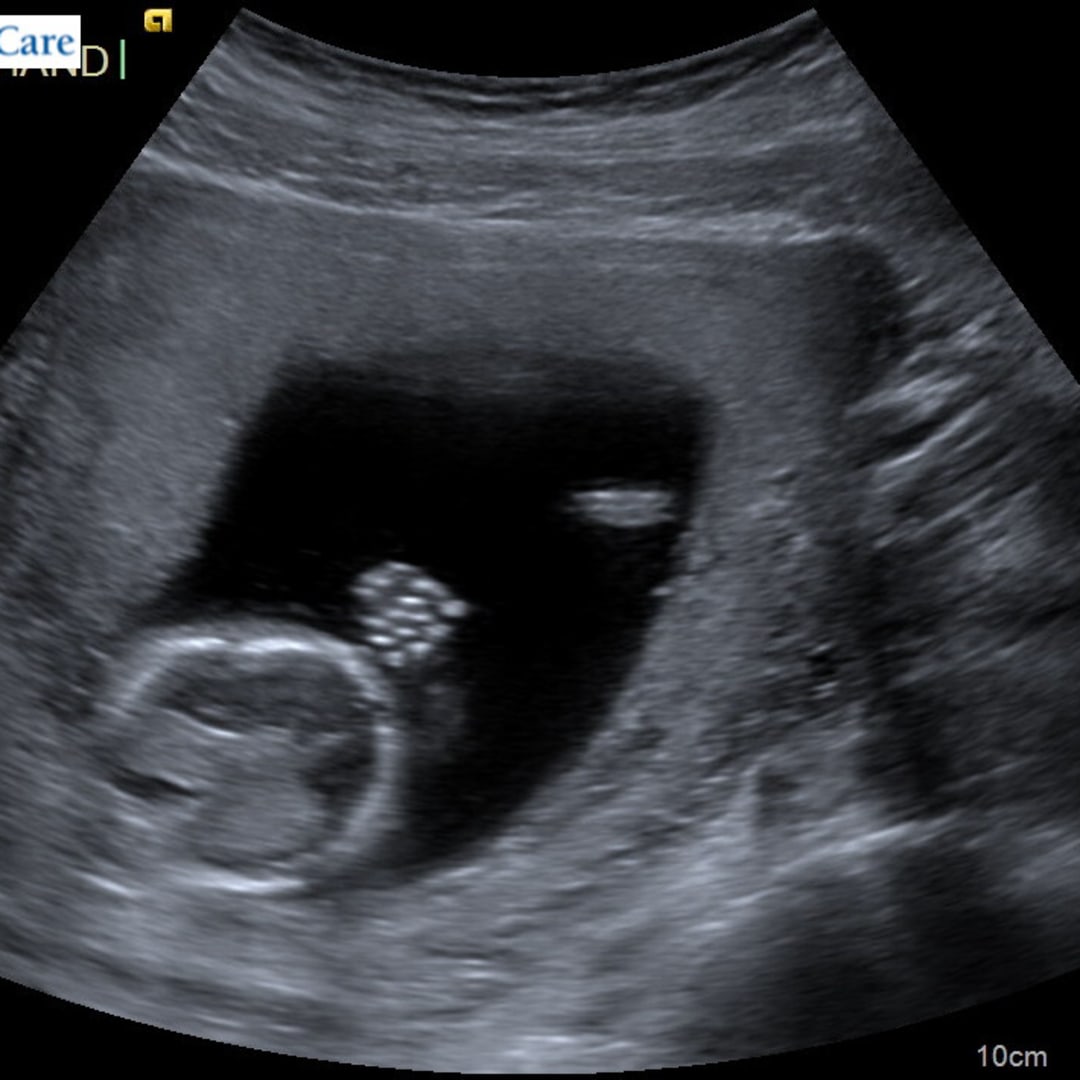 Photo shared by Athena for their Babylist baby registry.