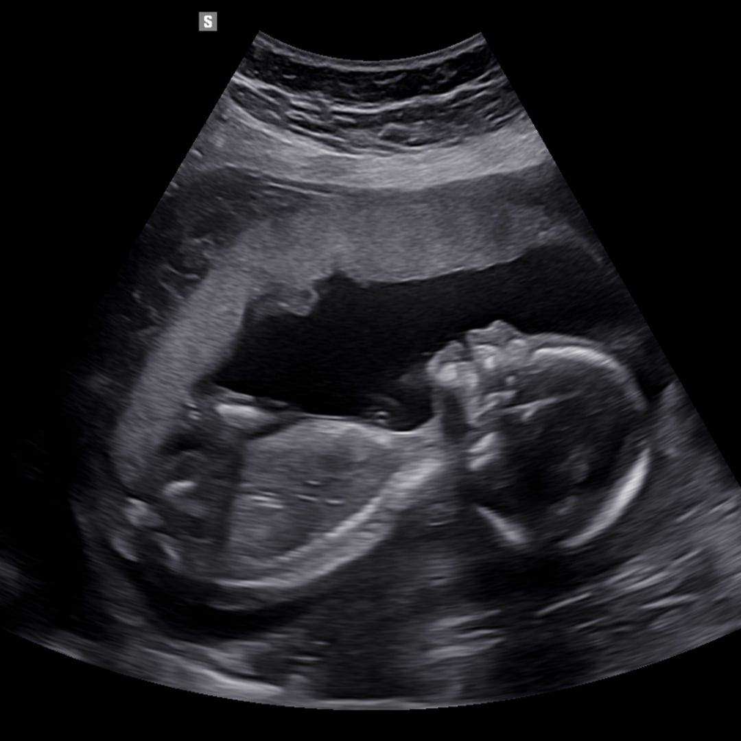 Photo shared by Gloria for their Babylist baby registry.