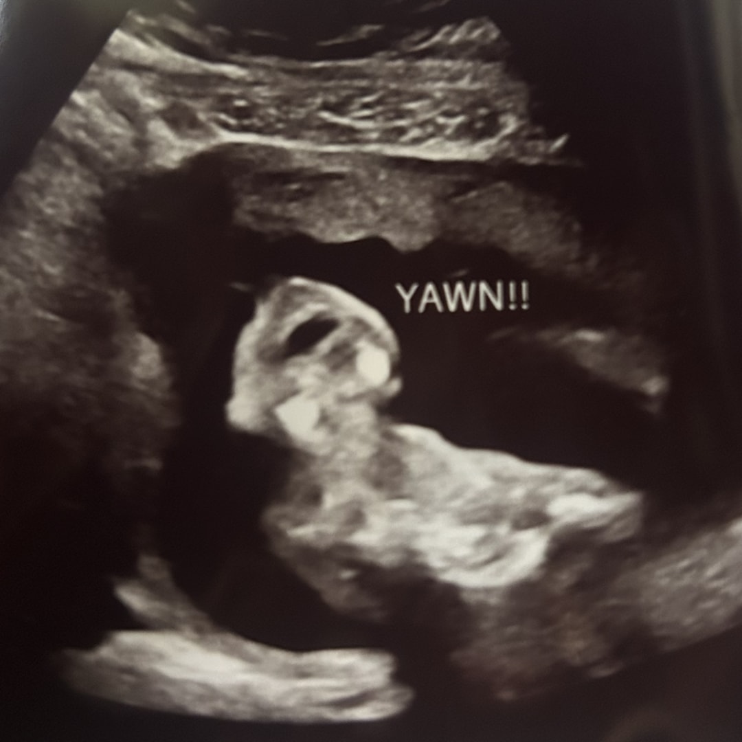 Photo shared by Keona for their Babylist baby registry.