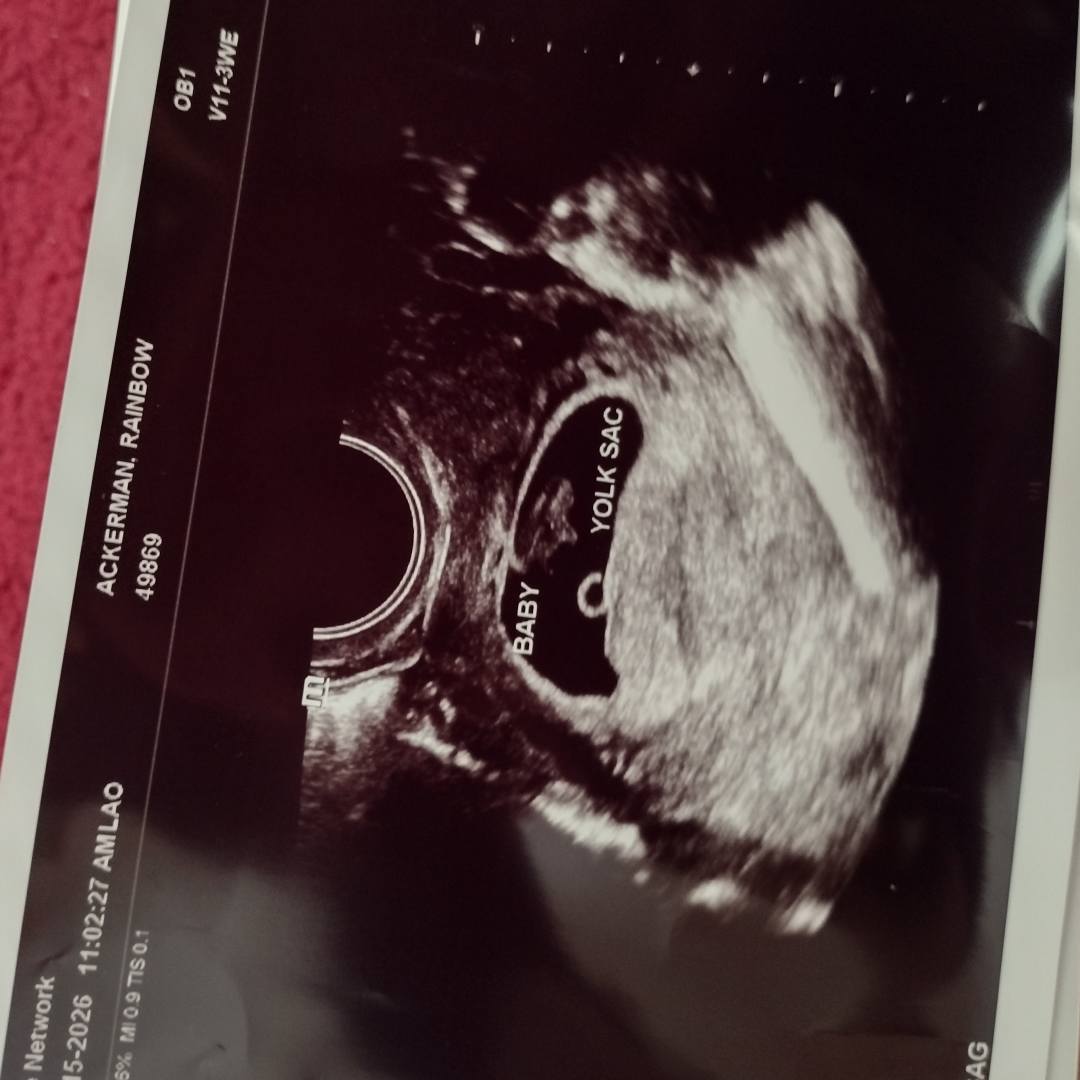 Photo shared by Rainbow for their Babylist baby registry.