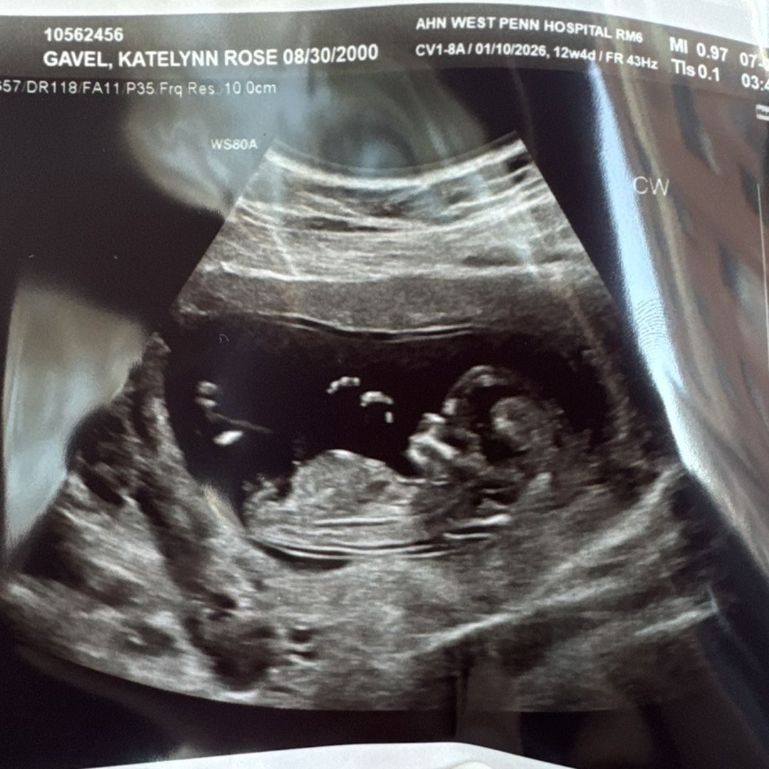 Photo shared by Katelynn for their Babylist baby registry.