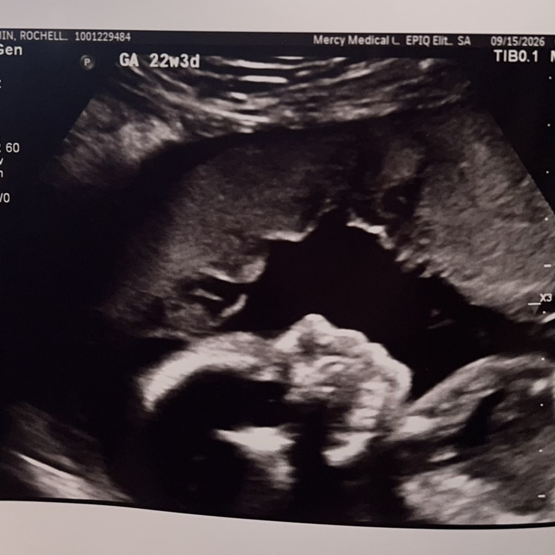 Photo shared by Annabell for their Babylist baby registry.
