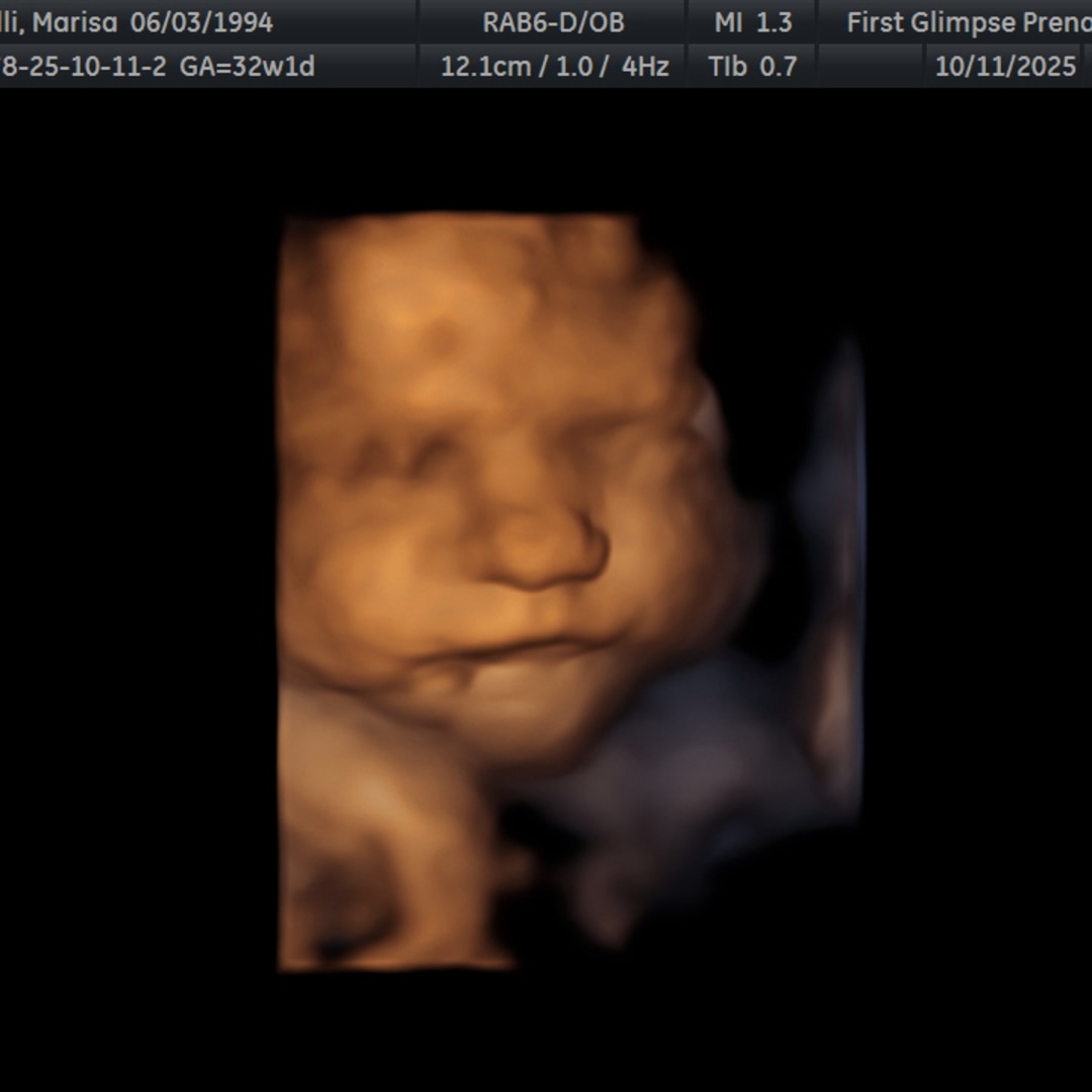 Photo shared by Marisa for their Babylist baby registry.