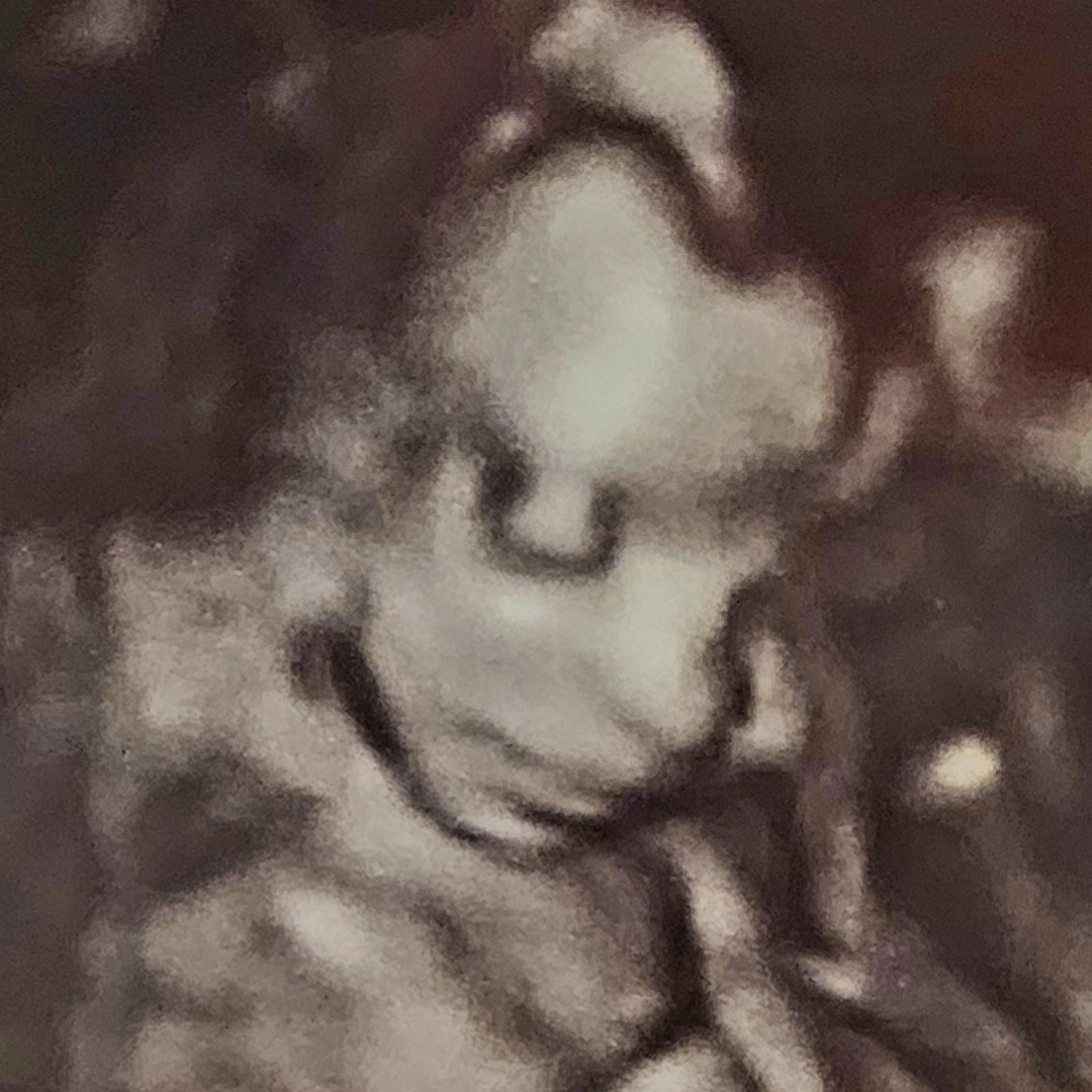 Photo shared by Emily for their Babylist baby registry.