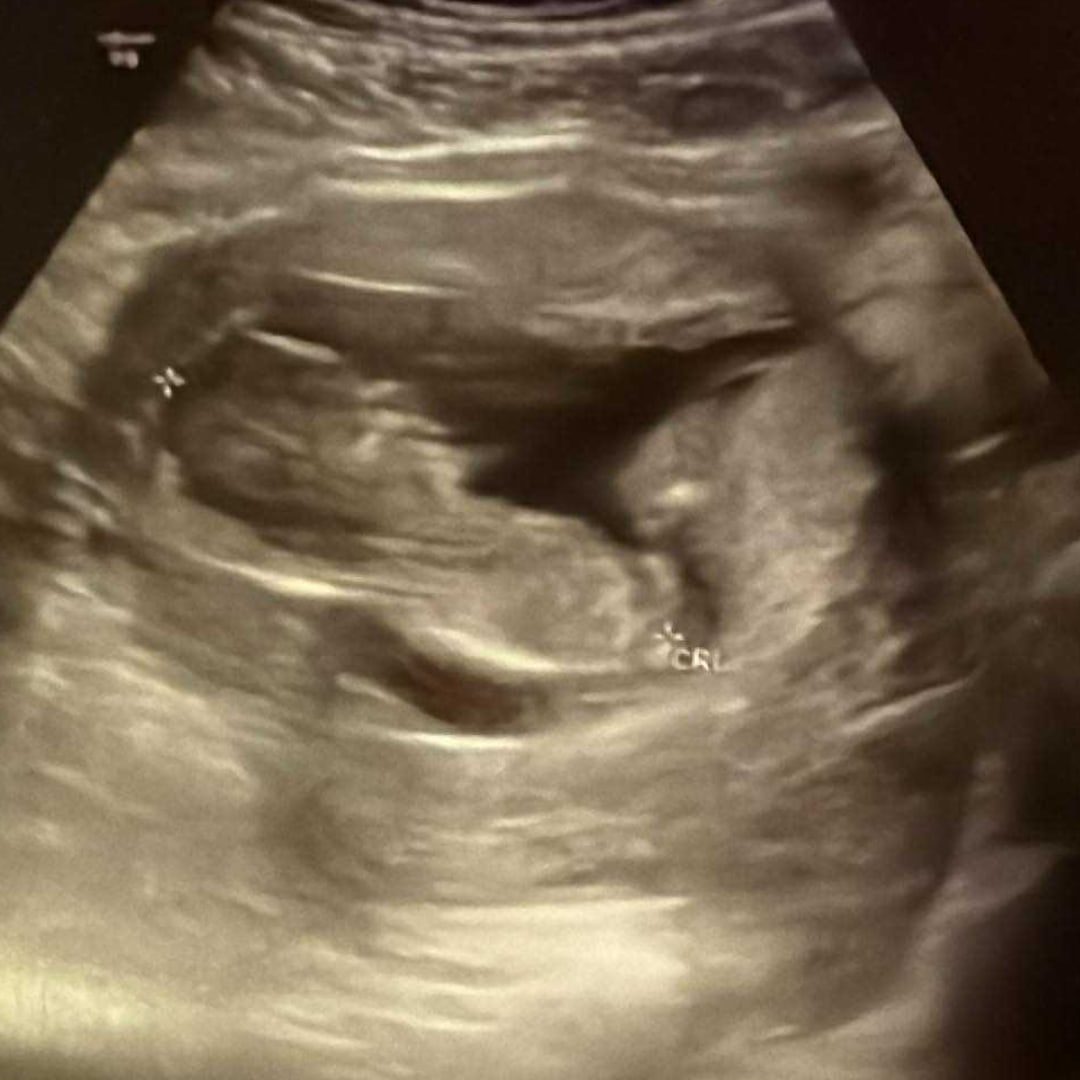 Photo shared by Tiffany for their Babylist baby registry.