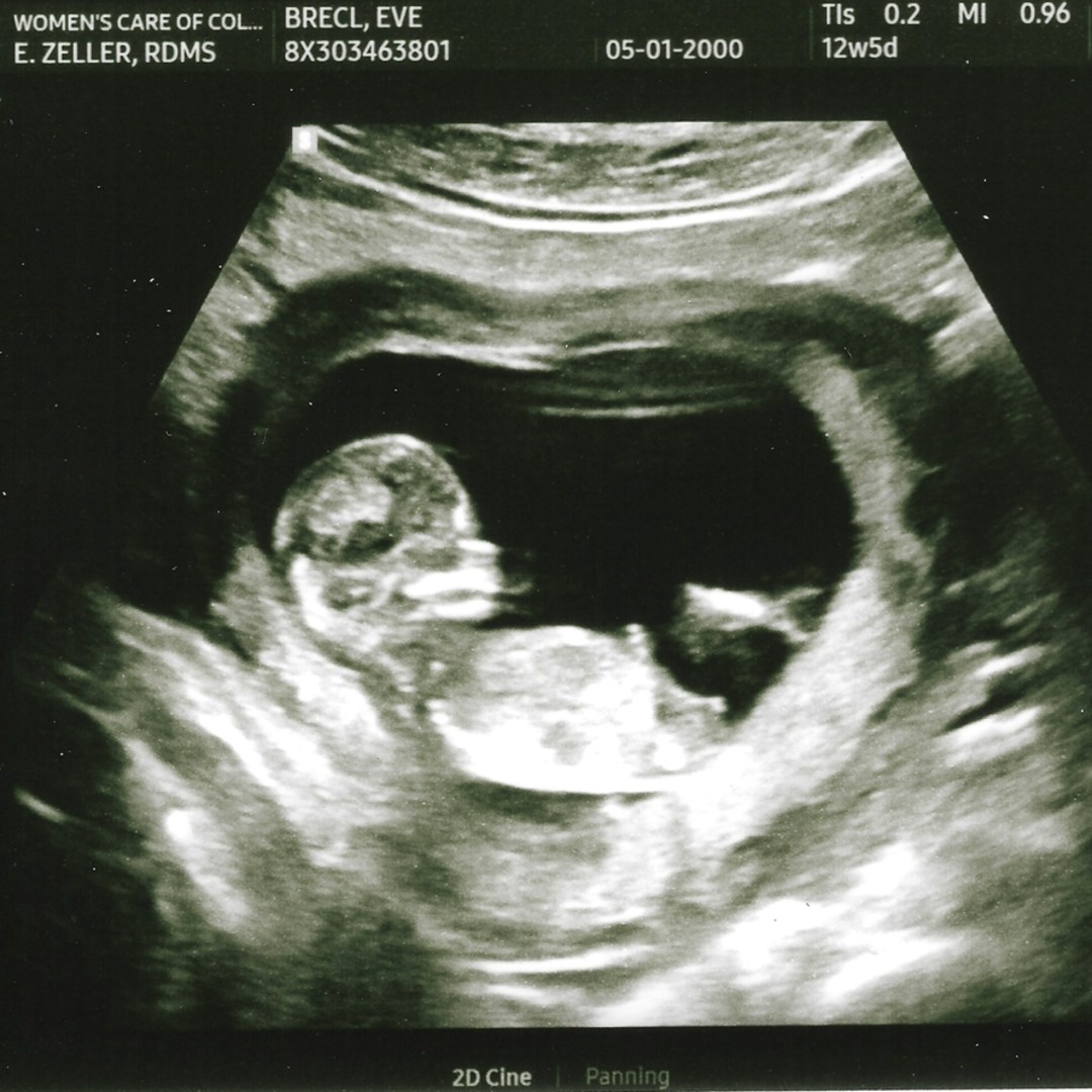 Photo shared by Eve for their Babylist baby registry.