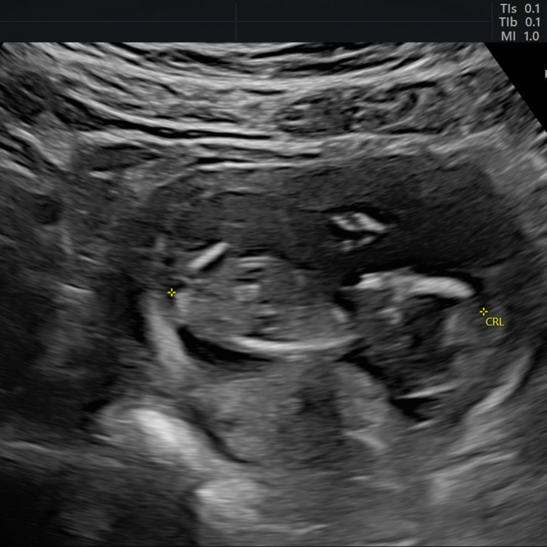 Photo shared by Taylor for their Babylist baby registry.