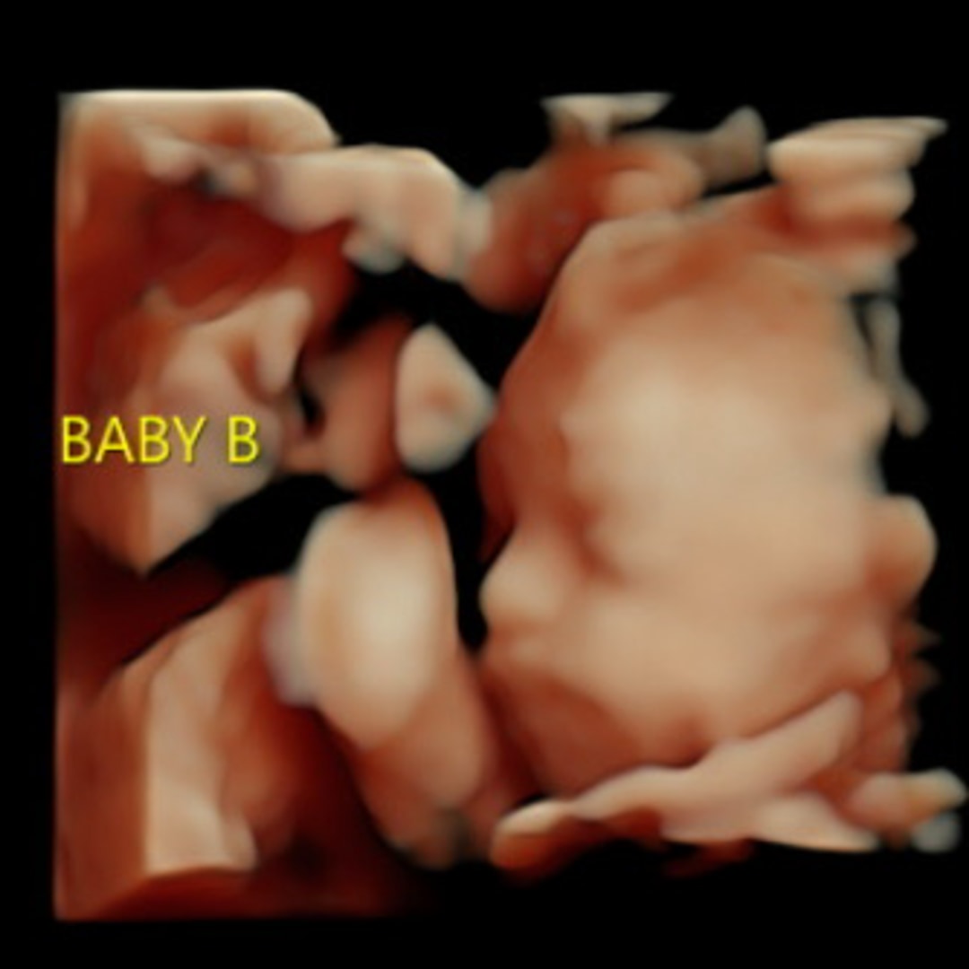 Photo shared by Emma for their Babylist baby registry.