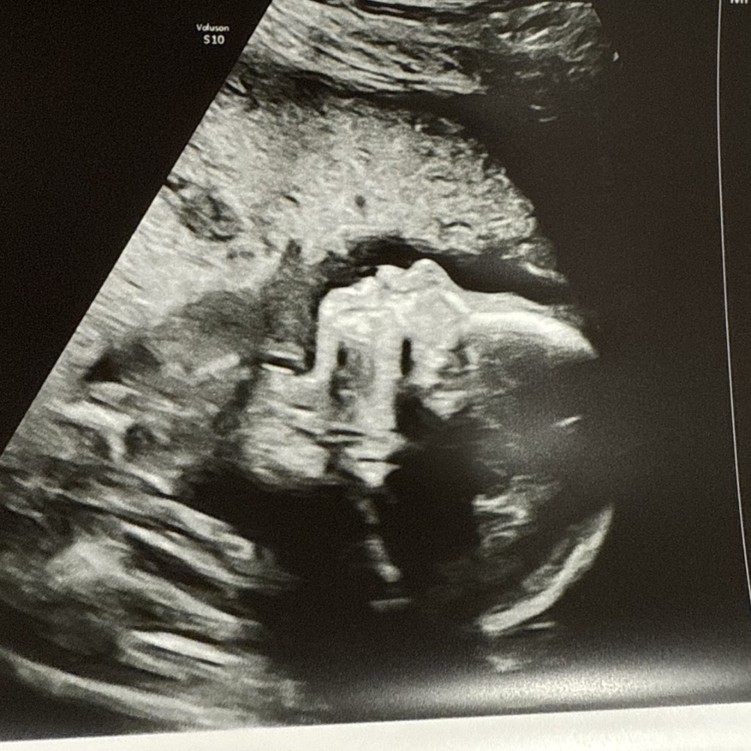 Photo shared by Mackenzie for their Babylist baby registry.
