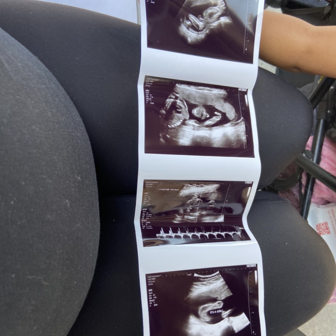 Photo shared by Ivon for their Babylist baby registry.