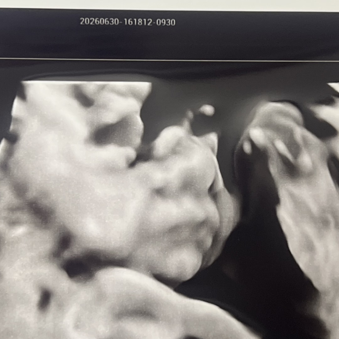 Photo shared by Anslee for their Babylist baby registry.