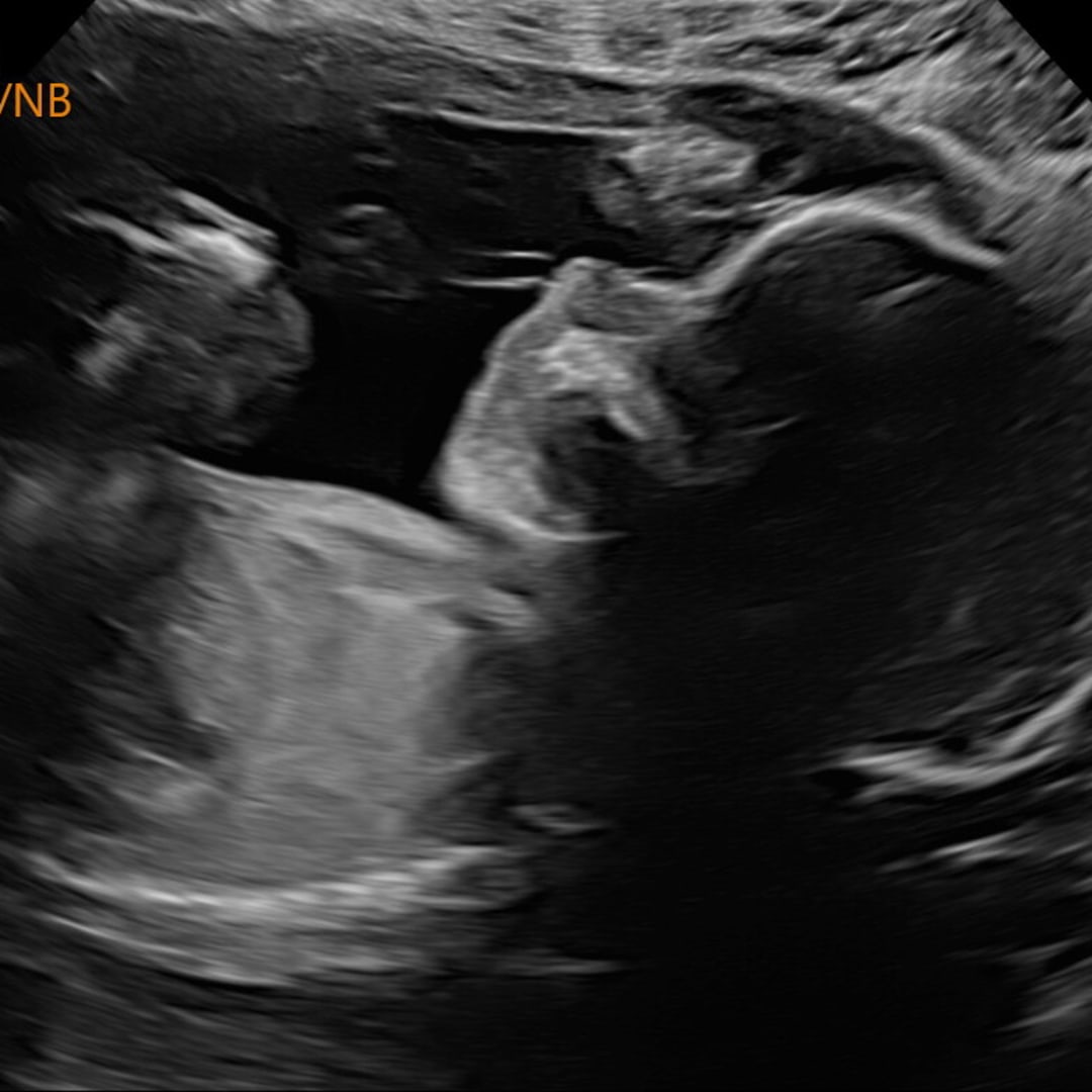 Photo shared by Amber for their Babylist baby registry.