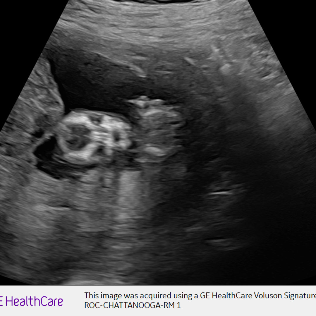 Photo shared by Sara for their Babylist baby registry.