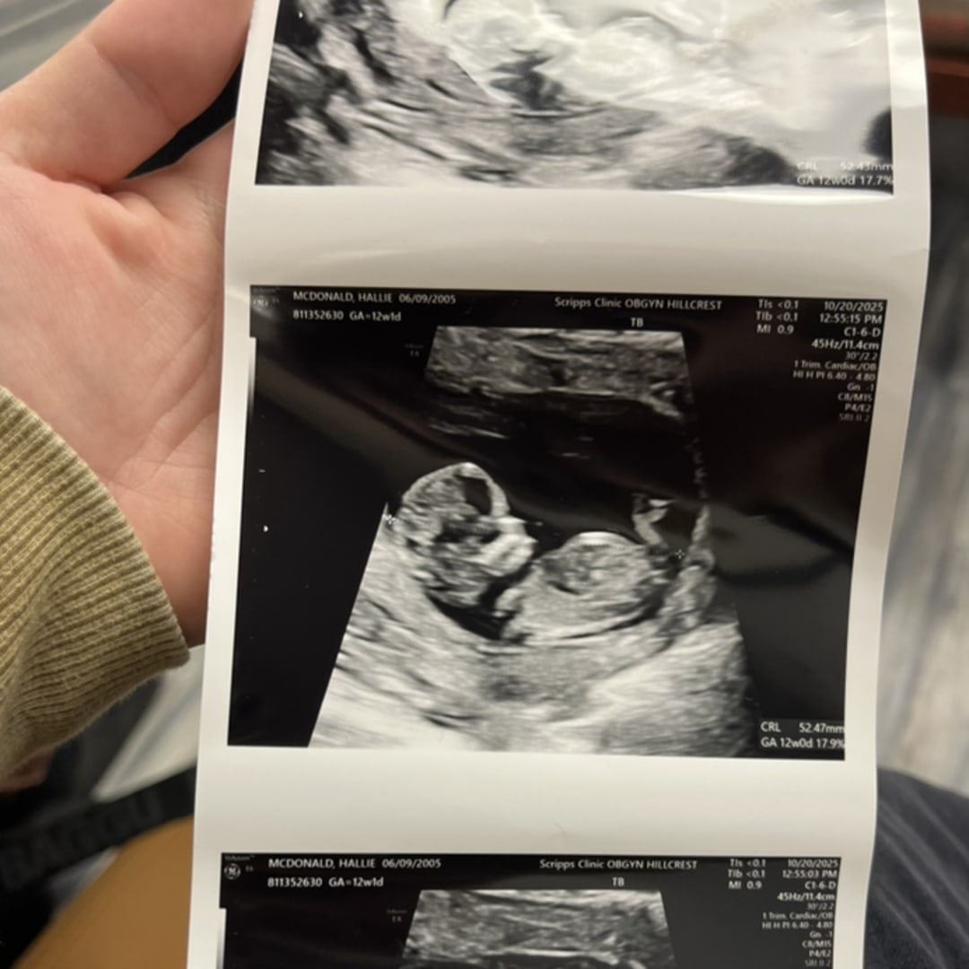 Photo shared by Hallie for their Babylist baby registry.