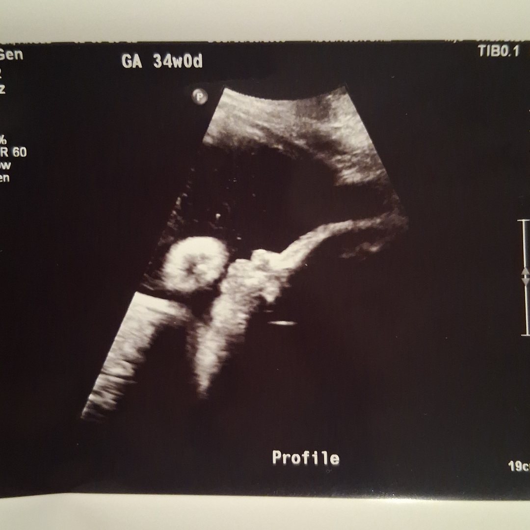 Photo shared by Angel for their Babylist baby registry.
