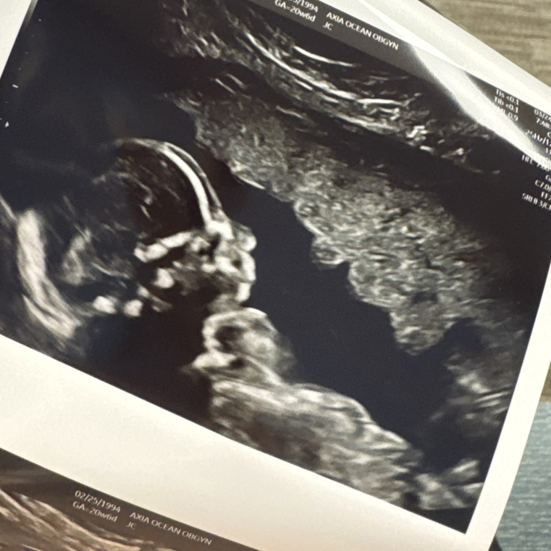 Photo shared by Sara for their Babylist baby registry.