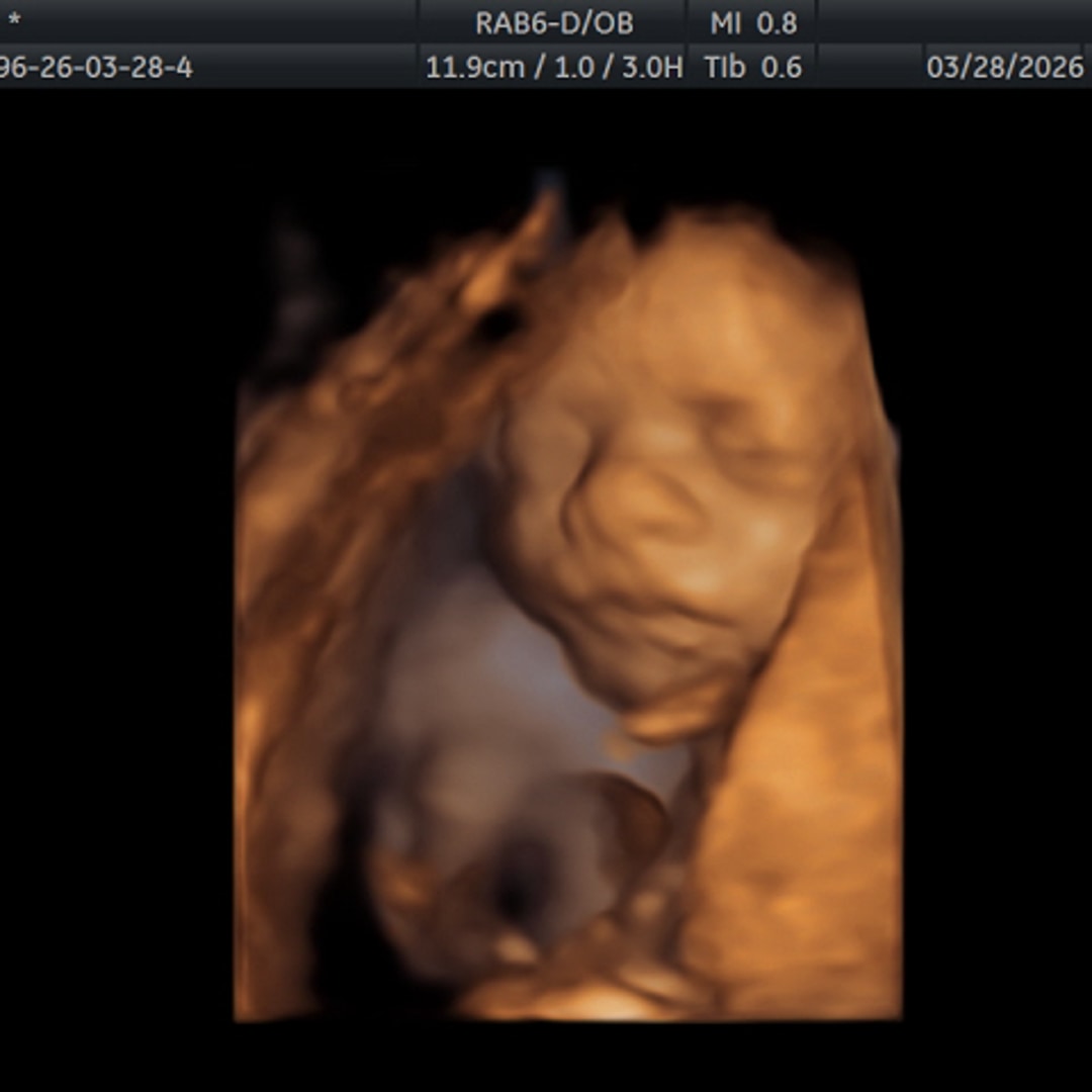 Photo shared by Sierra for their Babylist baby registry.