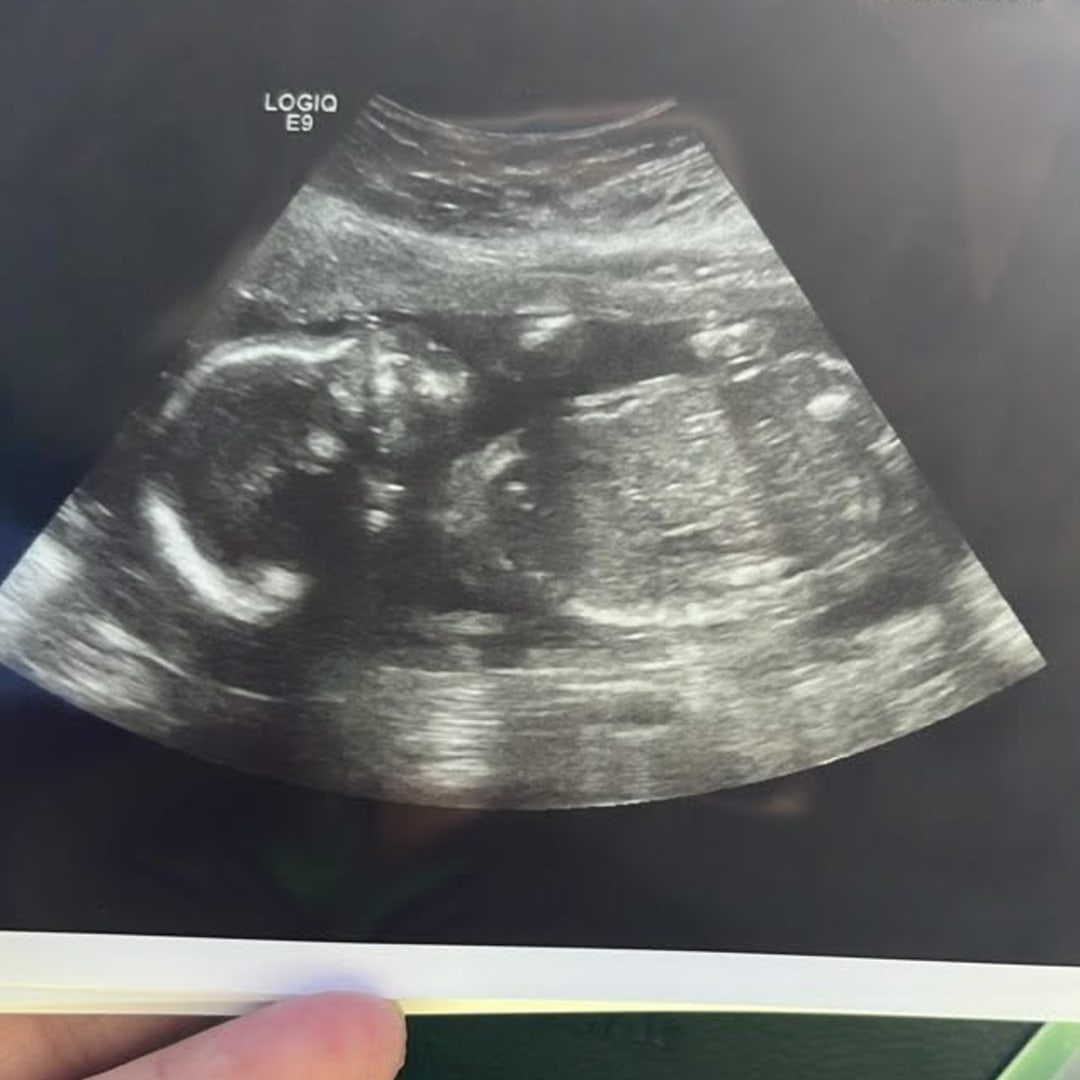 Photo shared by Harley for their Babylist baby registry.