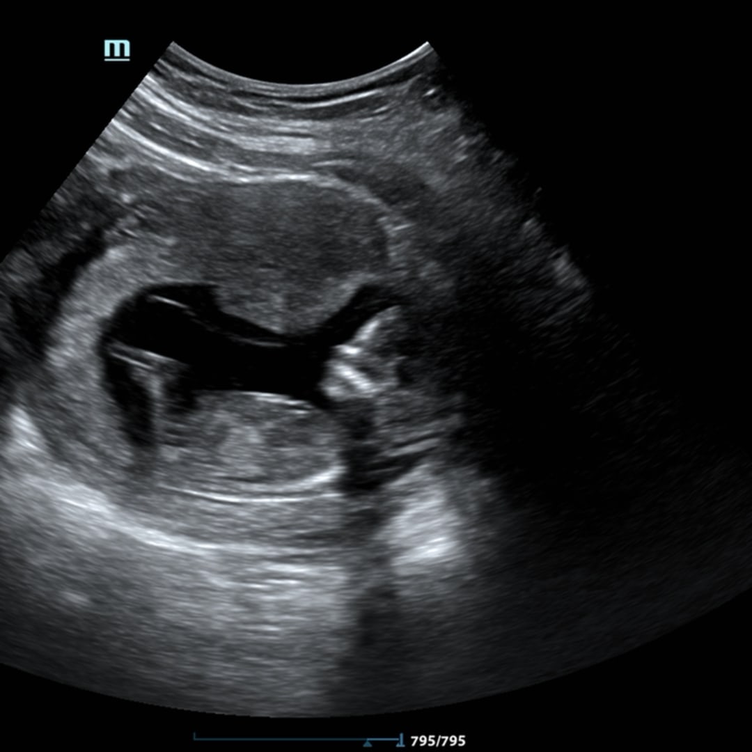 Photo shared by Rikki for their Babylist baby registry.