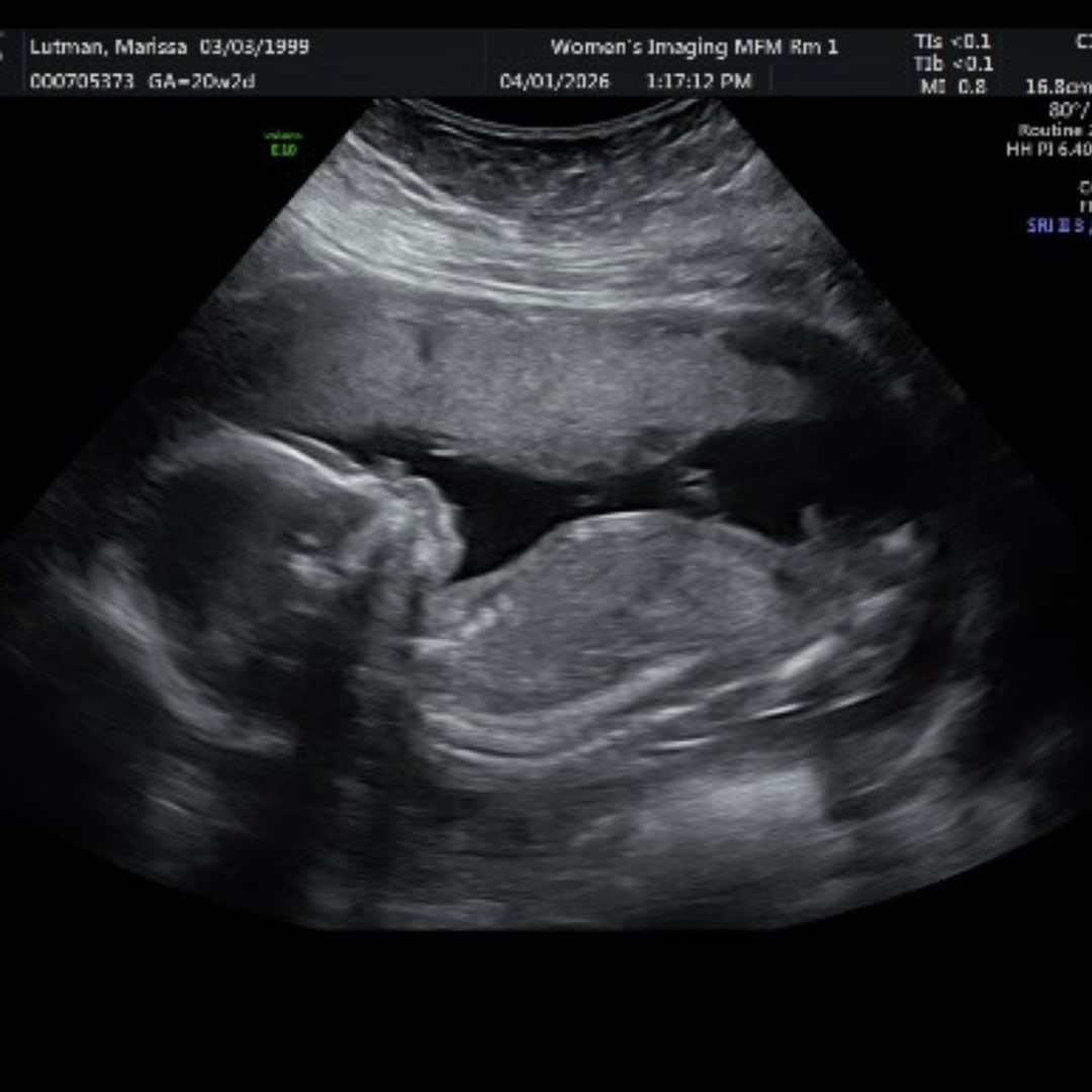 Photo shared by Marissa for their Babylist baby registry.