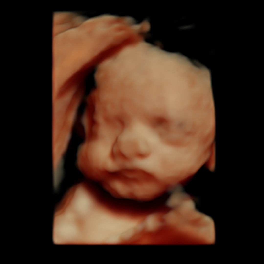 Photo shared by Lindsey for their Babylist baby registry.