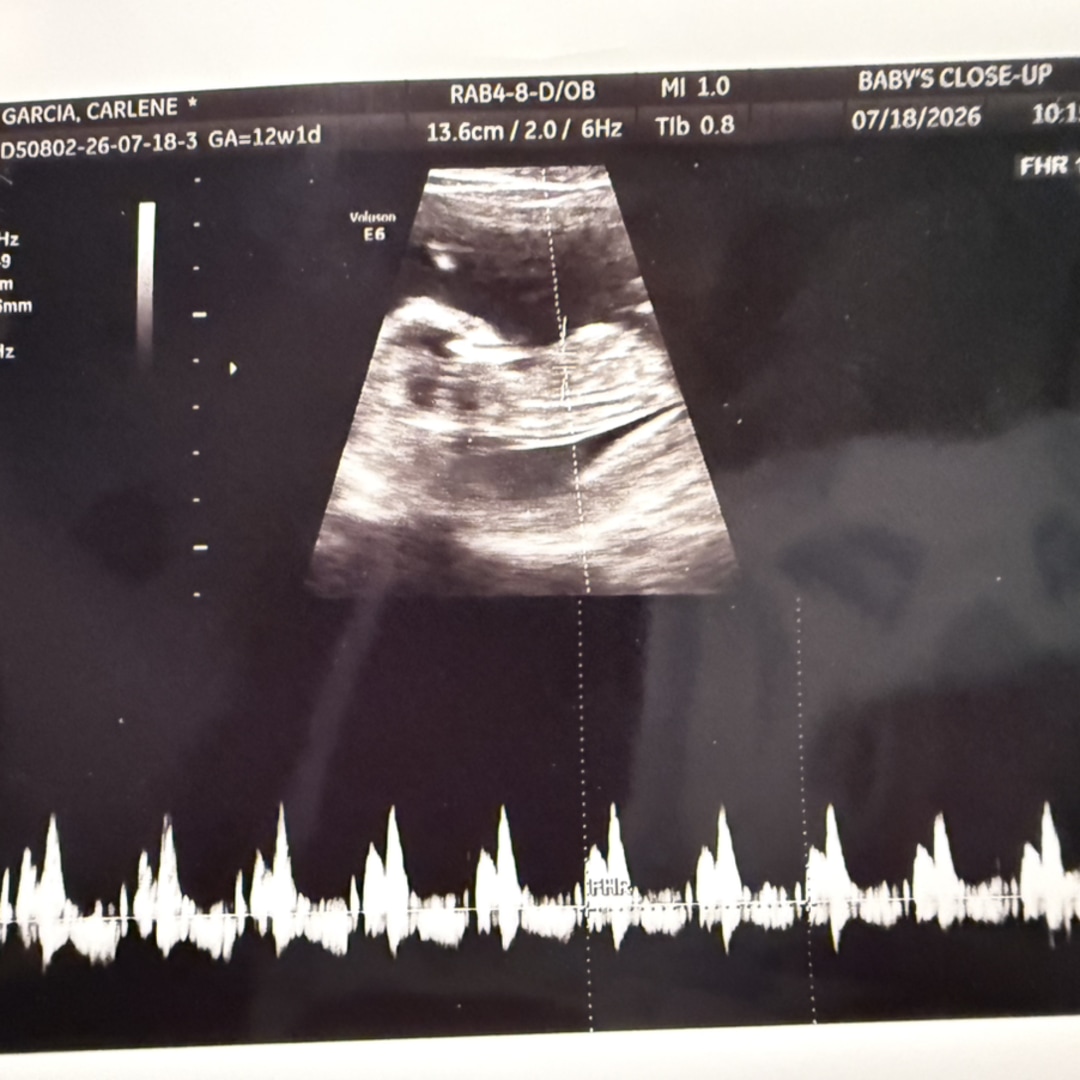 Photo shared by Carlene for their Babylist baby registry.