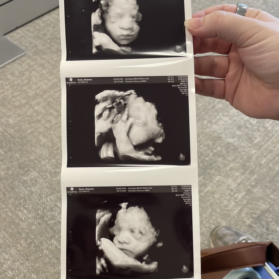 Photo shared by Shannon for their Babylist baby registry.