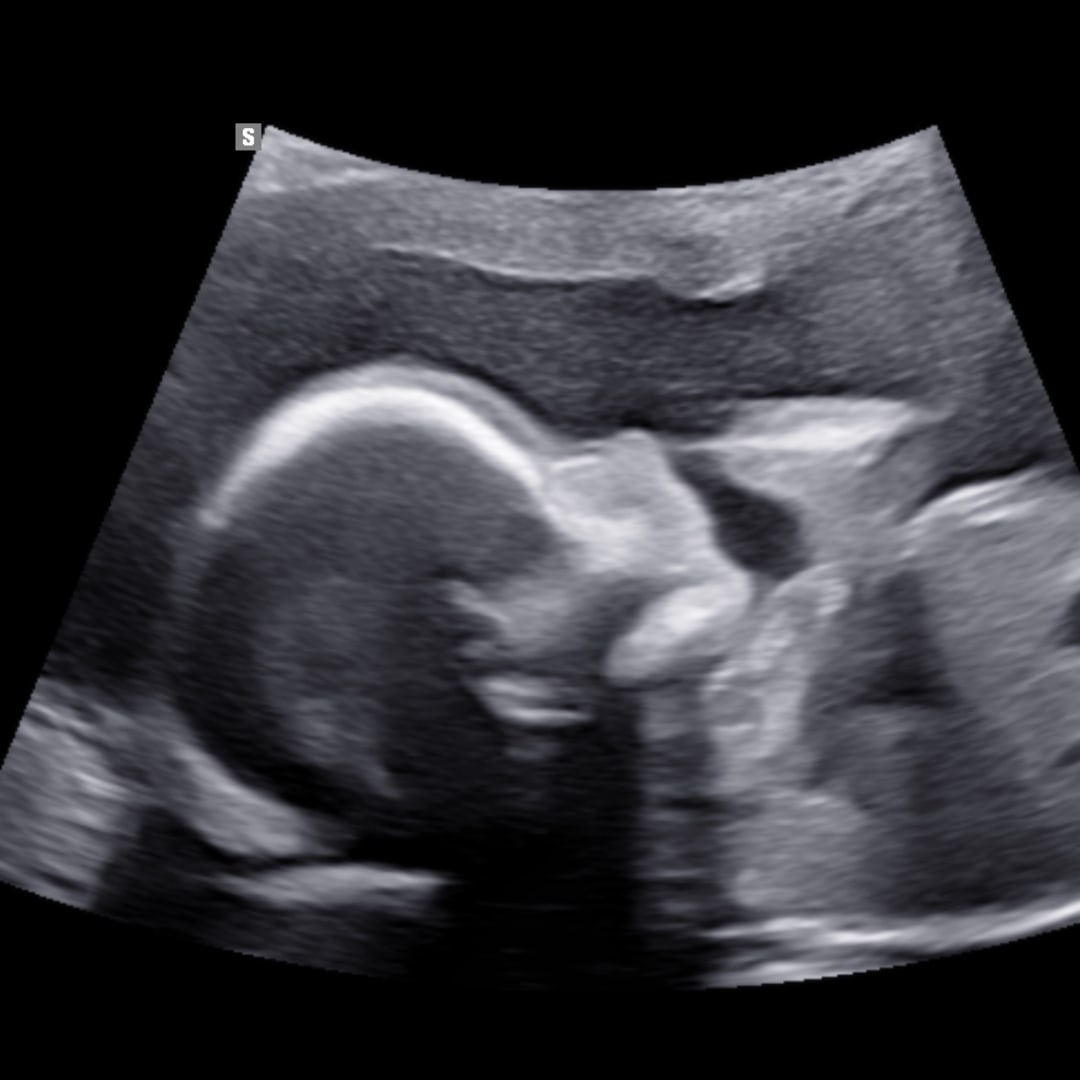 Photo shared by Laura for their Babylist baby registry.