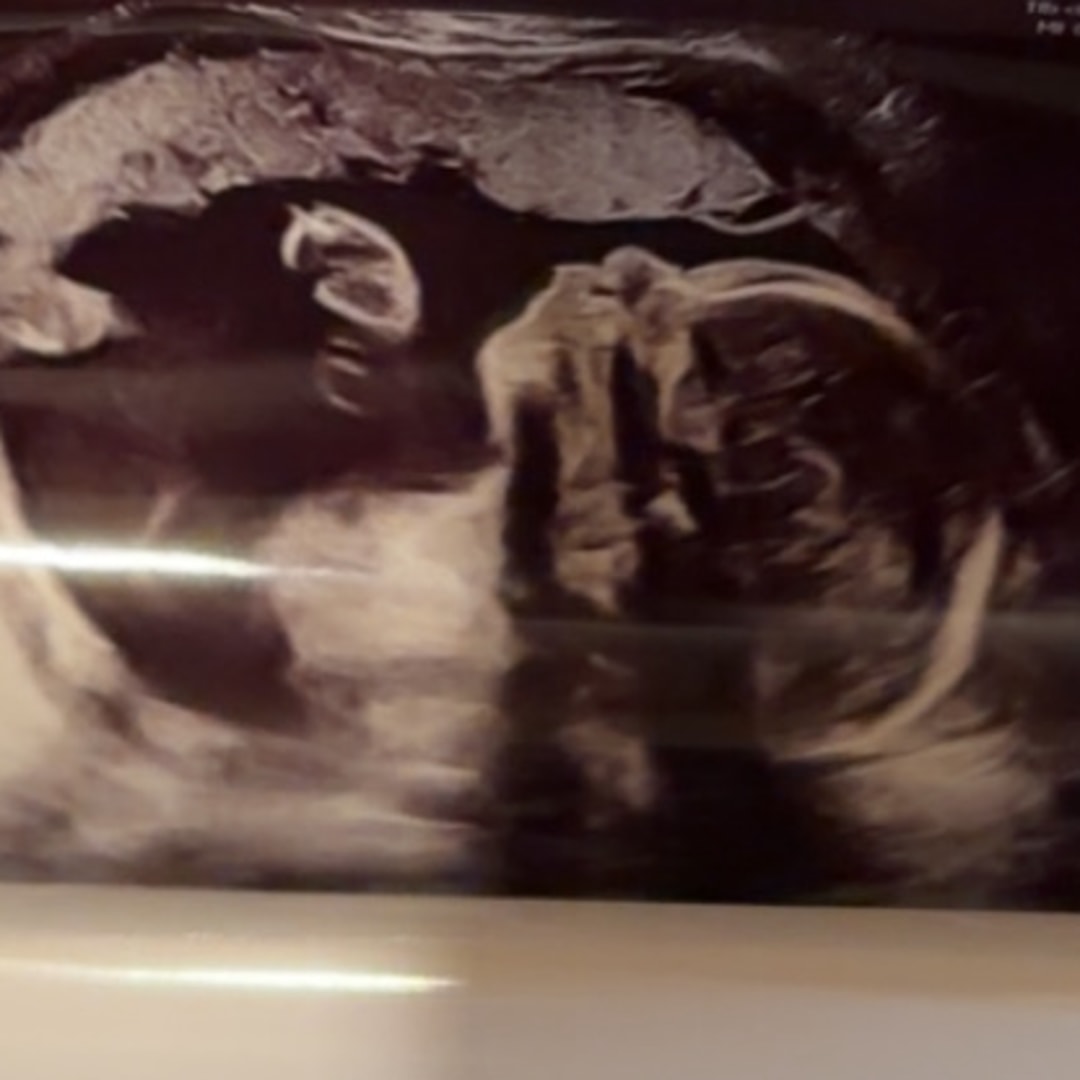 Photo shared by Brittney for their Babylist baby registry.