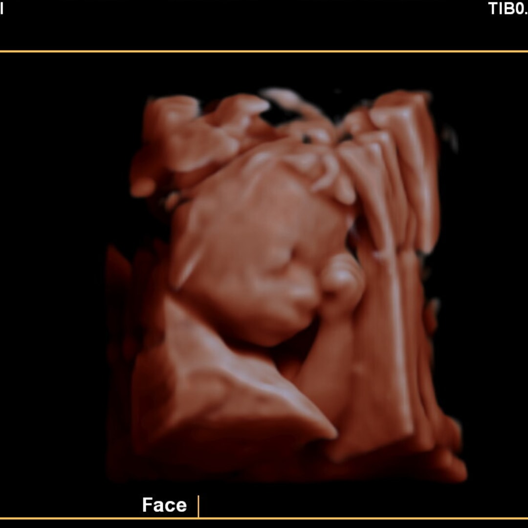 Photo shared by Ashley for their Babylist baby registry.