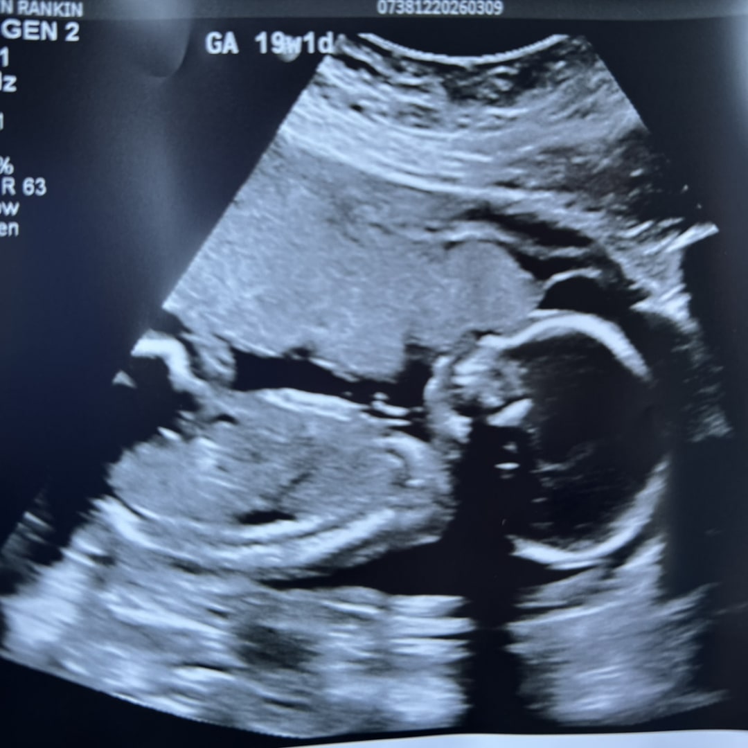 Photo shared by Kaitlyn for their Babylist baby registry.