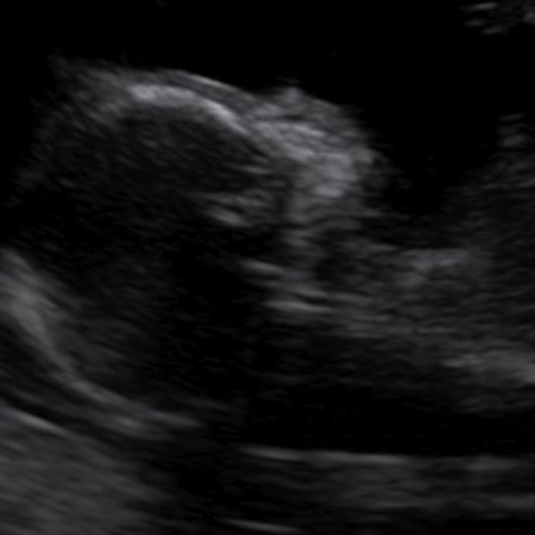 Photo shared by Suzanna for their Babylist baby registry.