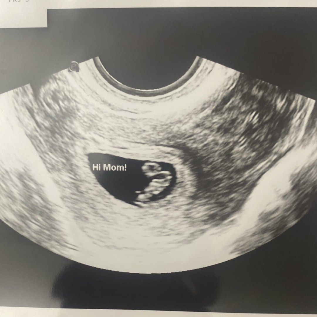 Photo shared by Alexis for their Babylist baby registry.