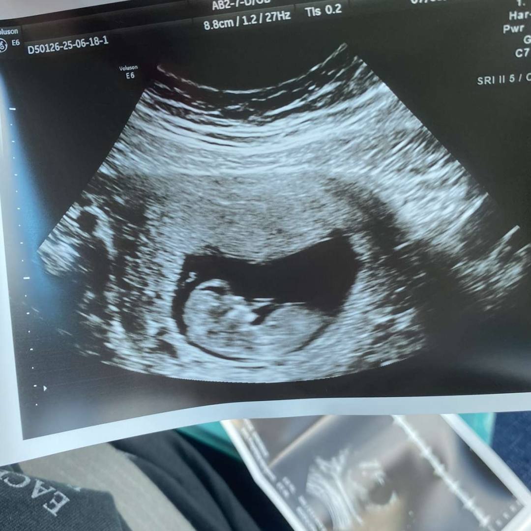 Photo shared by Ethan for their Babylist baby registry.