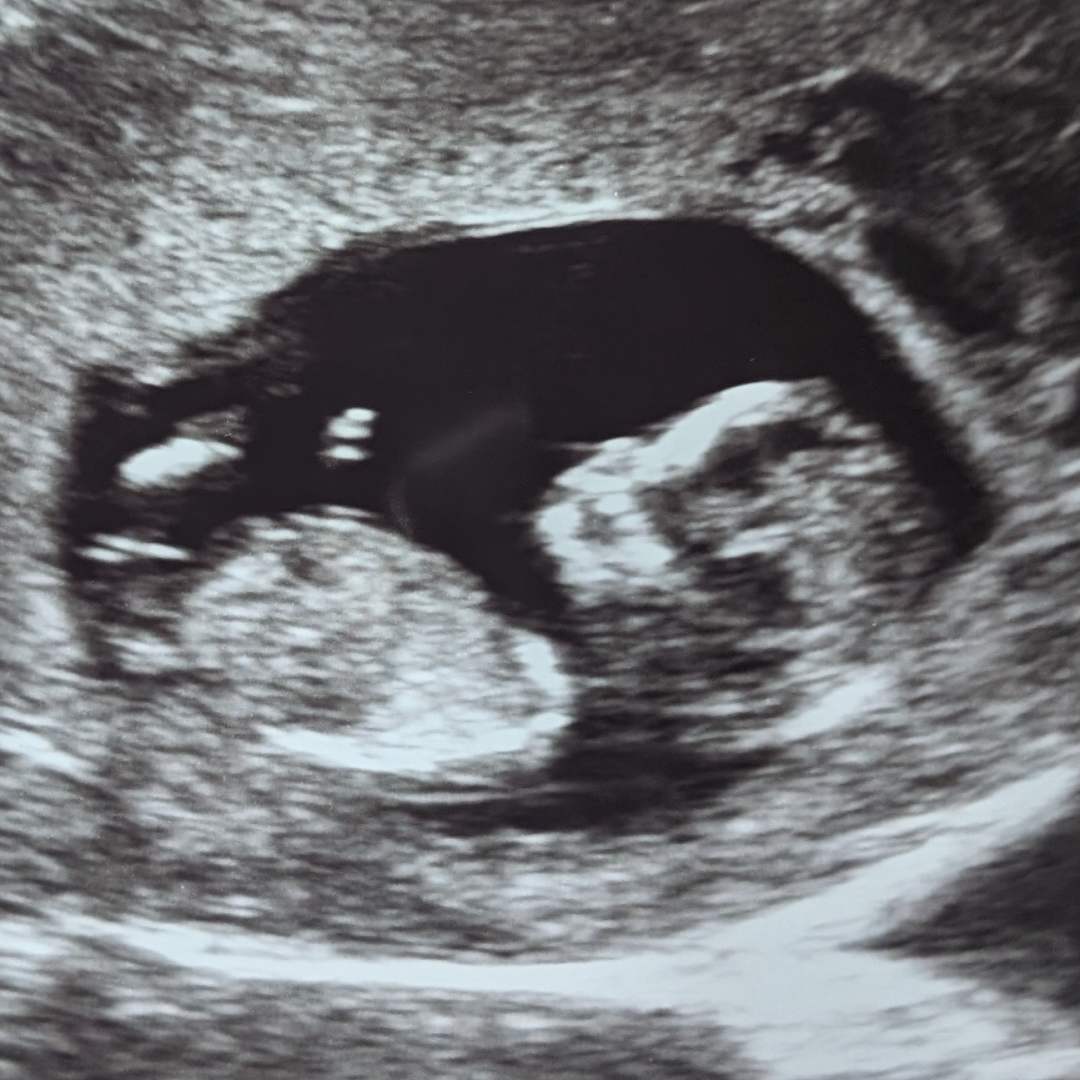 Photo shared by Deanne for their Babylist baby registry.