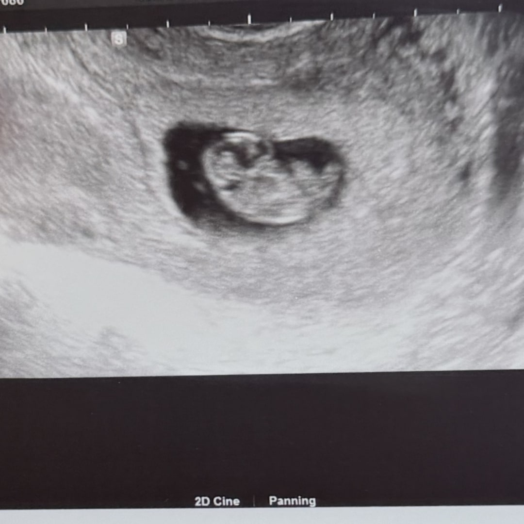 Photo shared by Ravin for their Babylist baby registry.