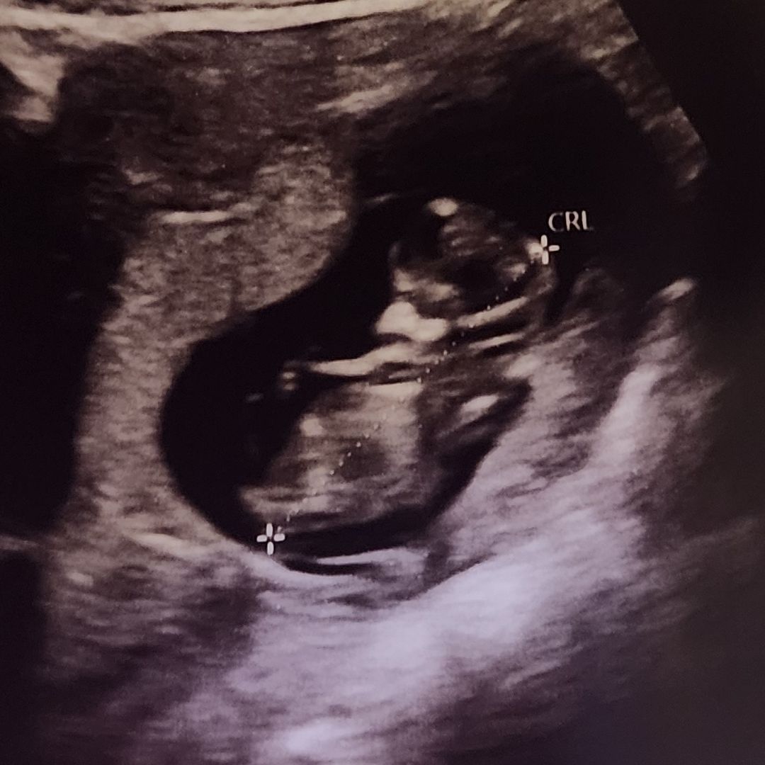 Photo shared by Alicia for their Babylist baby registry.