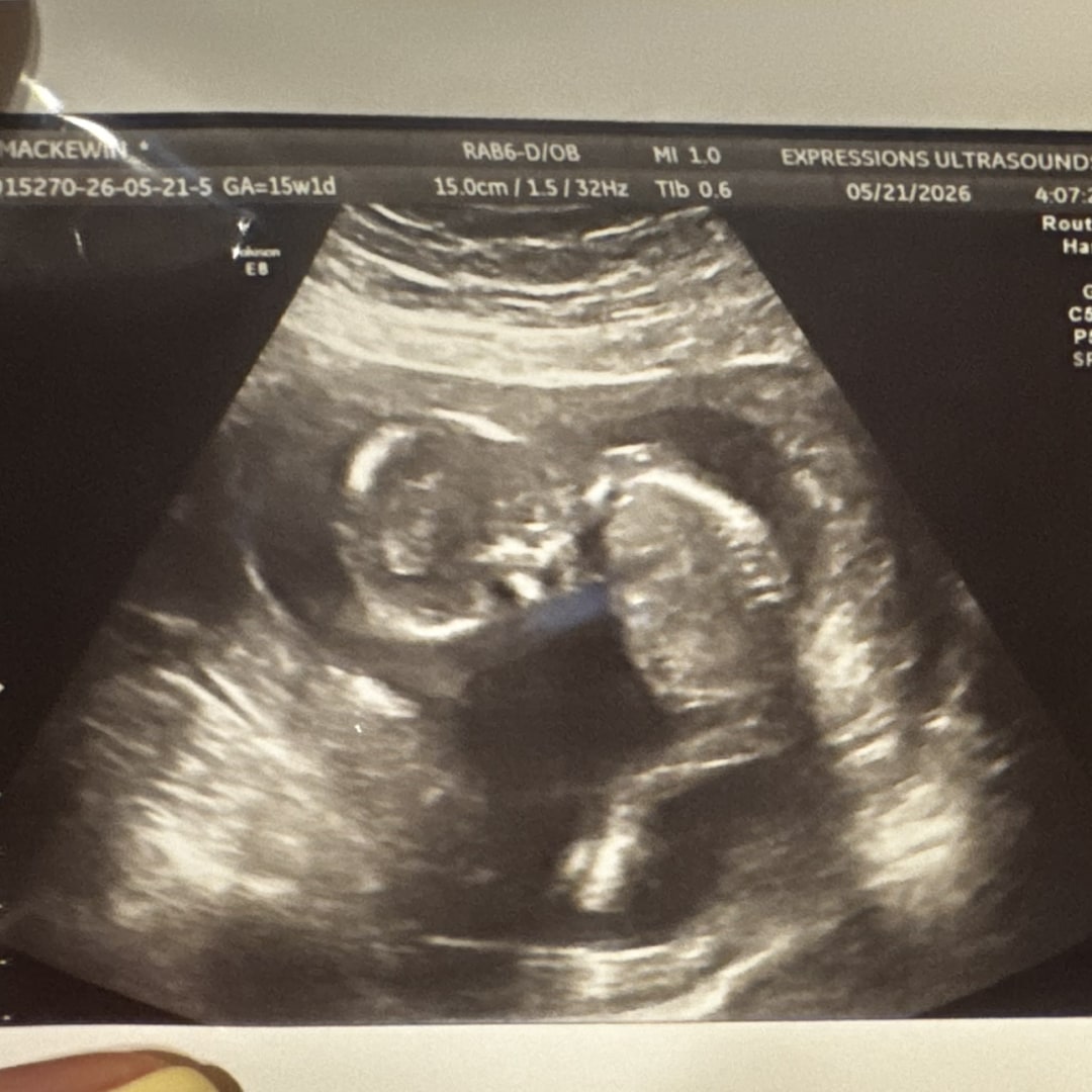 Photo shared by Mackewin for their Babylist baby registry.